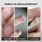 💅 50% RABATT! ✨ 3‑in‑1 Elektro-Nagelknipser – Mit Feilenfunktion & sicher ✨